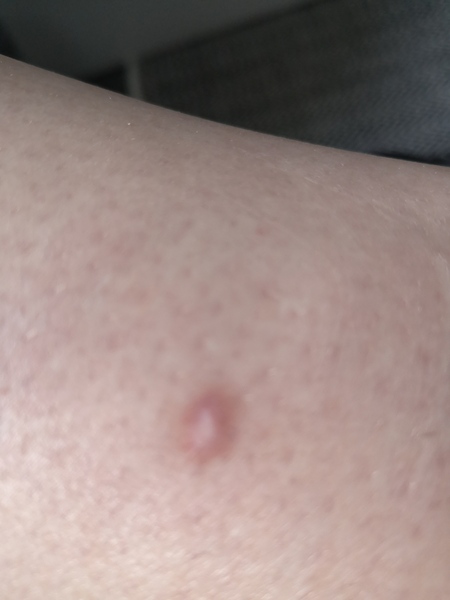 Do I need to get this patch on my leg checked out?