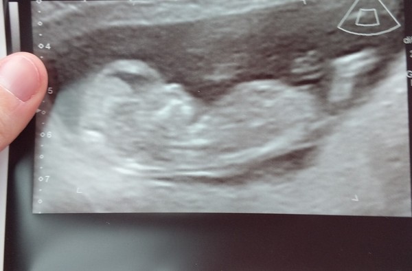 Jan 2020 - Thread 5!!