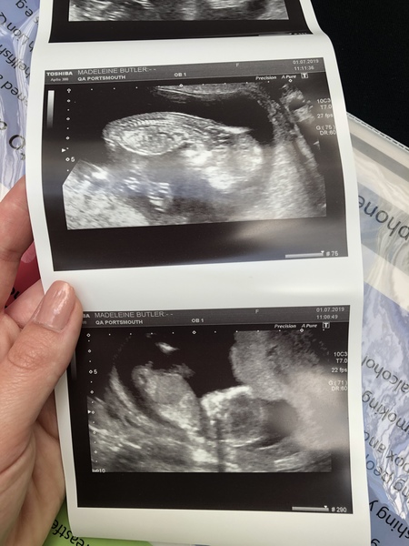 Jan 2020 - Thread 5!!