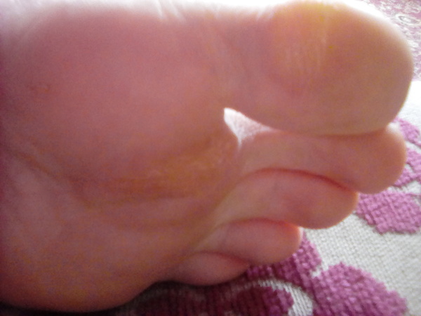 Gross feet (photos included)