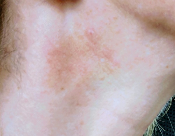 What is this? Skin related