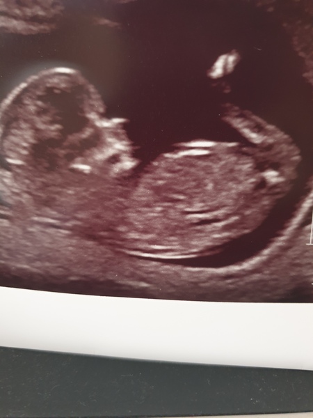 Will it be a boy or girl?? Any guesses please?