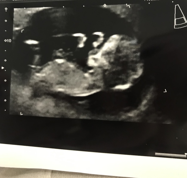 Gender guesses??