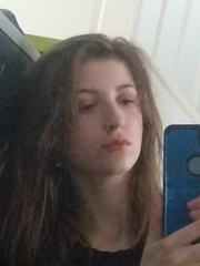 To consider a nose job/rhinoplasty? Photos