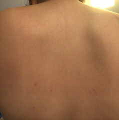 Rash - any ideas?