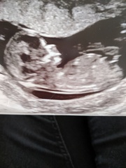 Boy or girl? You had it right last time!
