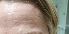 Why is my skin so rank?
