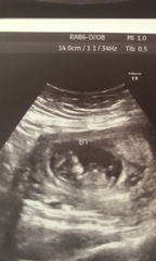 Gender guess for my twinnies??