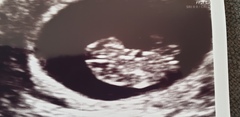 The Graduates of TTC after pregnancy loss thread #2 "The Penguin Huddle " 🐧🐧🐧
