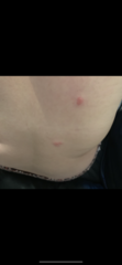 to wonder what this rash is?
