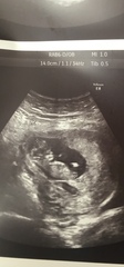 Gender guess for my twinnies??