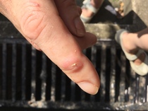 Is this normal for a gardening cut?