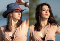 To consider a nose job/rhinoplasty? Photos