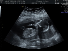 Just had a private gender scan at 16+2 weeks! What do you think?...