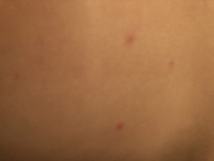Rash - any ideas?