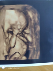 Christmas babies part 2