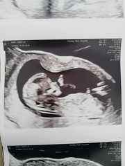 January babies, pregnant after miscarriage :)