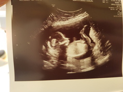 boy or girl, just for fun 😍