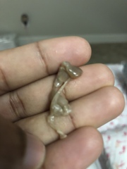 Brown Discharge at 16 weeks