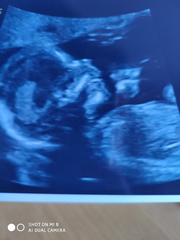 Christmas babies part 2