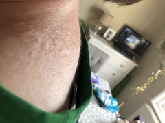 Wtf is this on my neck?!