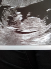 Boy or girl? You had it right last time!