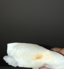 Does this LOOK like implantation