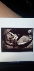 BFP - Anyone else due February 2020?