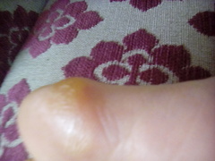 Gross feet (photos included)