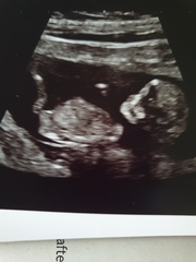 12 week gender guesses