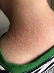 Wtf is this on my neck?!
