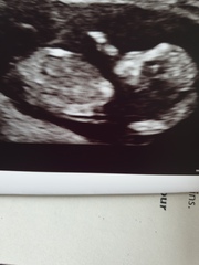 12 week gender guesses