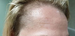 Why is my skin so rank?