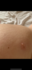 to wonder what this rash is?