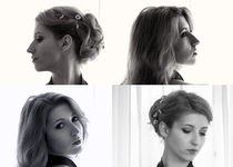To consider a nose job/rhinoplasty? Photos