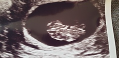 The Graduates of TTC after pregnancy loss thread #2 "The Penguin Huddle " 🐧🐧🐧