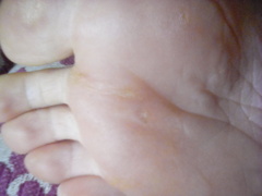 Gross feet (photos included)