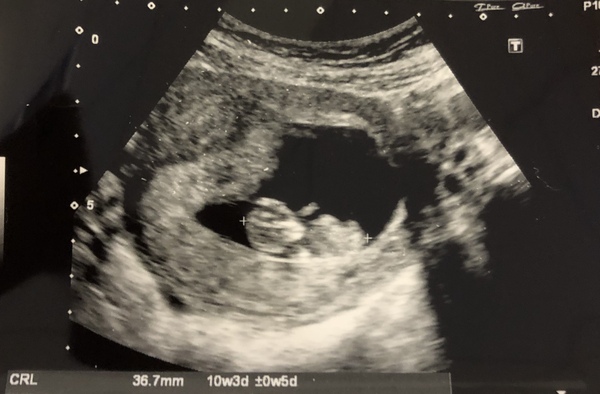 March Babies #2