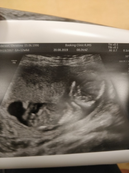 BFP - Anyone else feb 2020? Continued ...