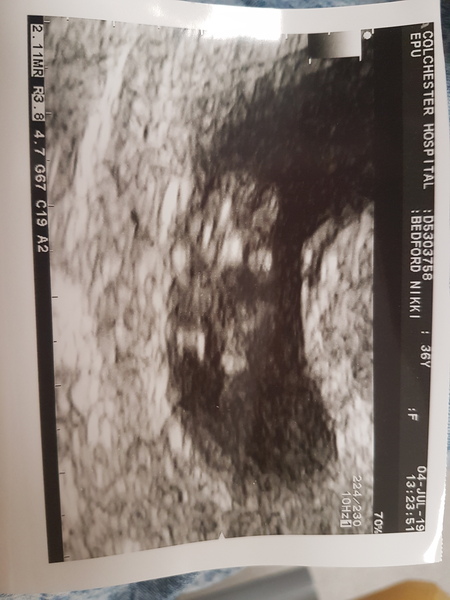 9 week scan - any photos?