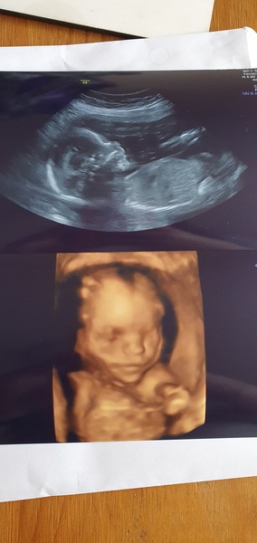 The Graduates of TTC after pregnancy loss thread #3 🐧🐧The Penguin Huddle 🐧🐧