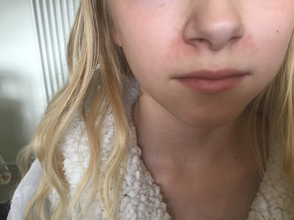 What could this rash be?