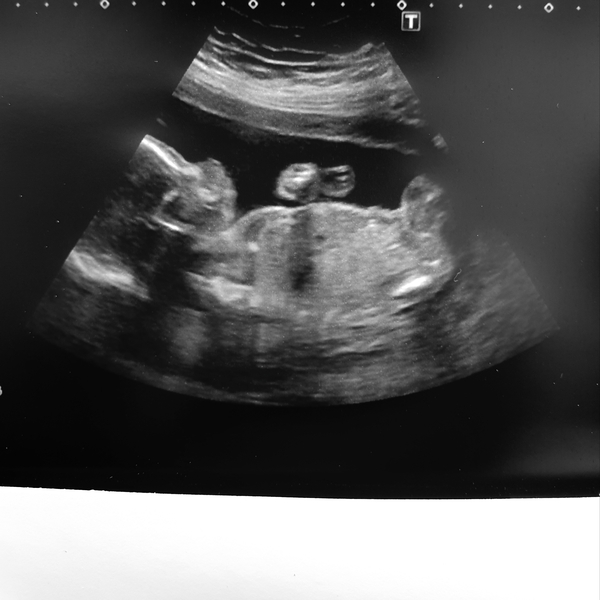 Christmas babies part 2