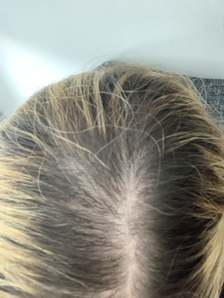 What should I do with my hair?