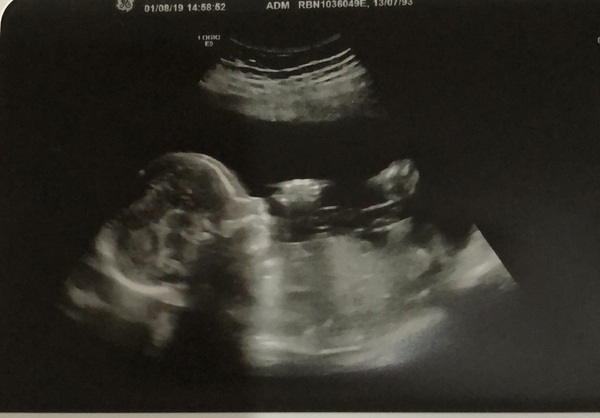 Gender guess?