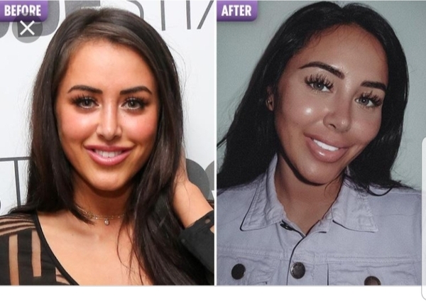 To think some of the celebrities WANT the weird look they have