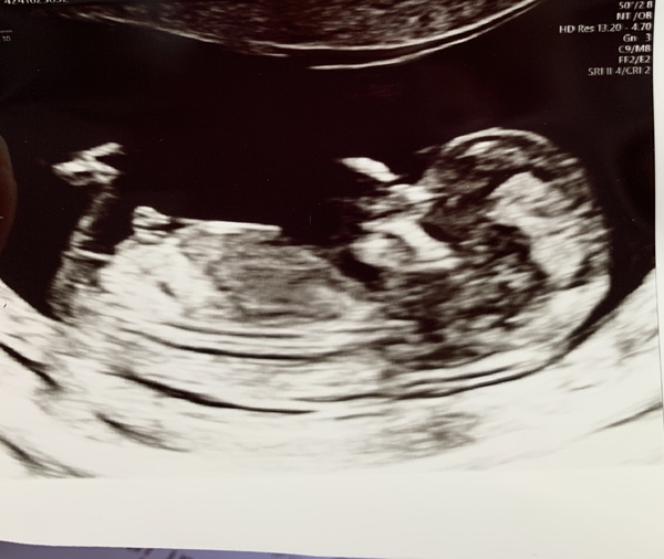 BFP - Anyone else feb 2020? Continued ...