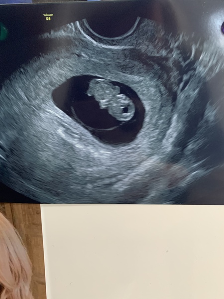 March Babies #3