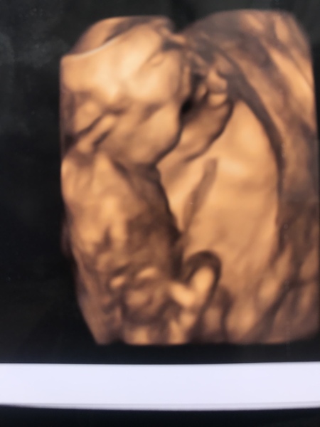 BFP - Anyone else feb 2020? Continued ...