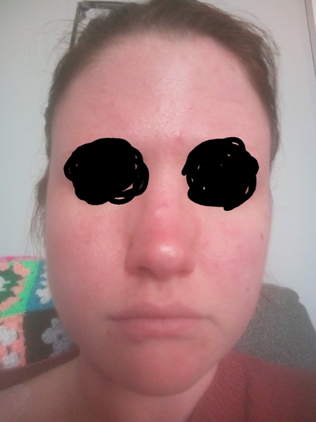 Please advise me on my skin
